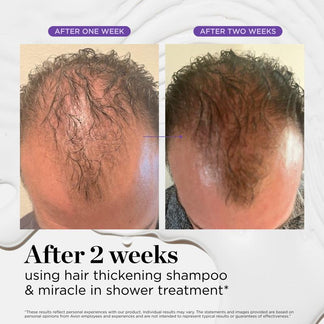 Dr. Groot: Scalp Revitalizing Solution Hair Thickening Shampoo