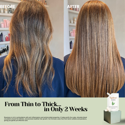 TGIDEAS ANTI-HAIR FALL SHAMPOO