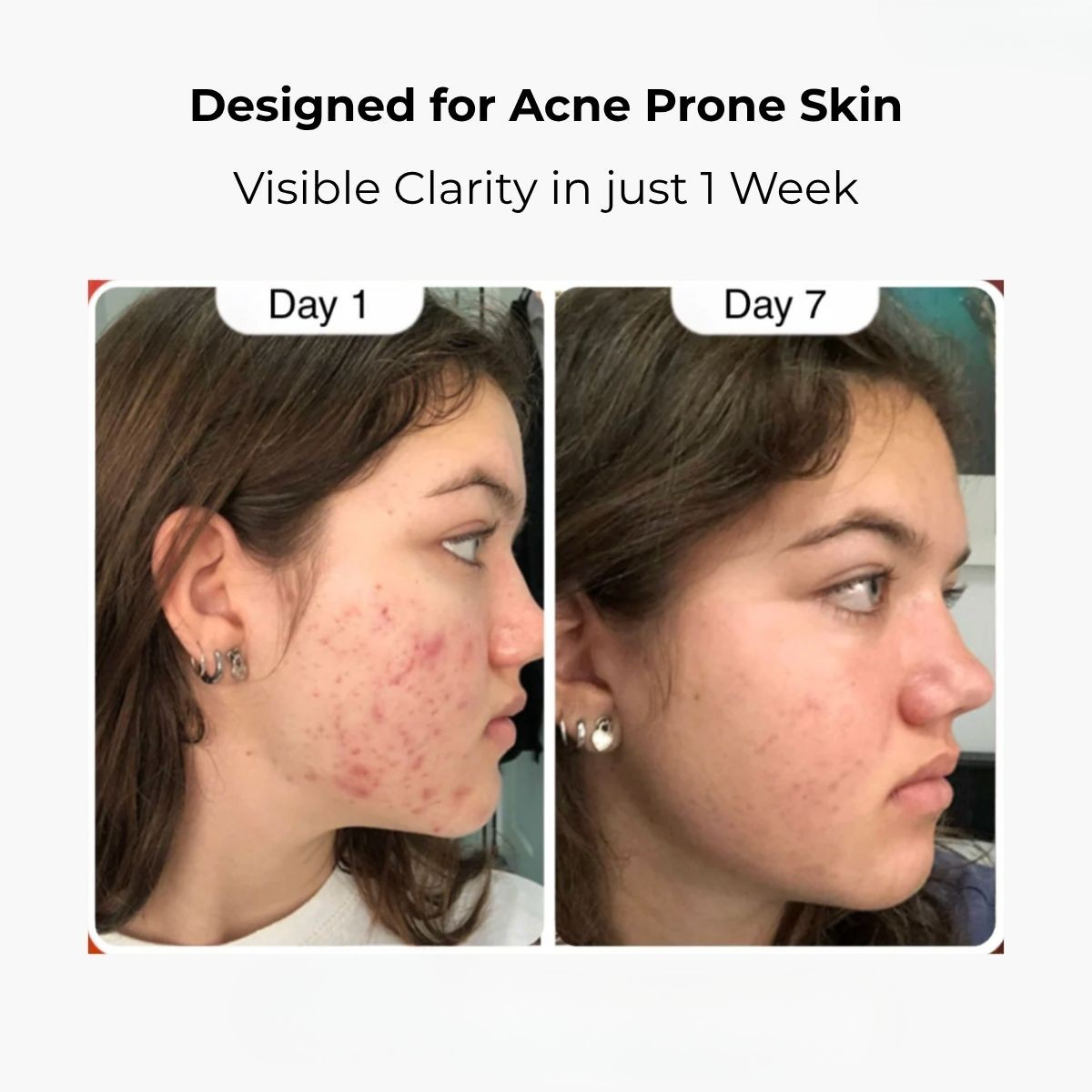 Hypochlorous Acid Rice Peel Shot Duo
