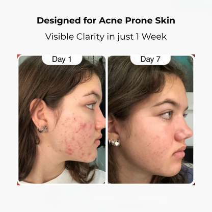 Hypochlorous Acid Rice Peel Shot Duo