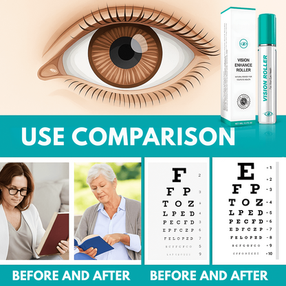 Vision Enhance roller