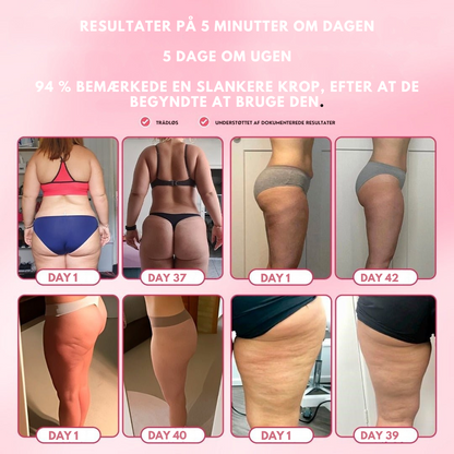 Ellevate TM Cellulite